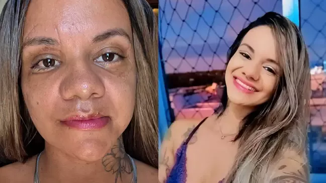 Mulher atacada com 61 socos dentro do elevador mostra recuperação; veja vídeo