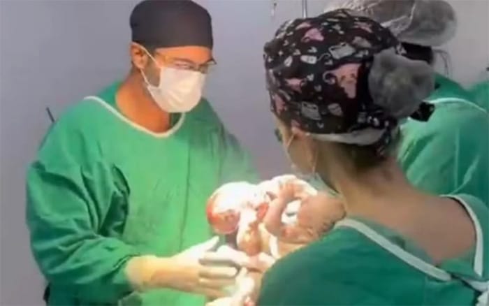 Gêmeos siameses de Mato Grosso nascem em Goiânia; bebês são meninos