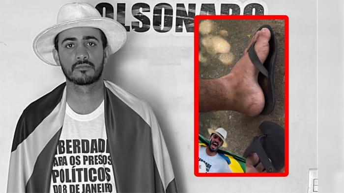 Supremo Tribunal Federal retira tornozeleira de bolsonarista de Cuiabá após mais de 3 anos