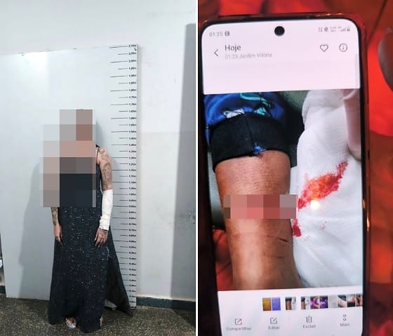 Mulher é presa após ataque contra filho de 3 anos e tentativa contra a própria vida