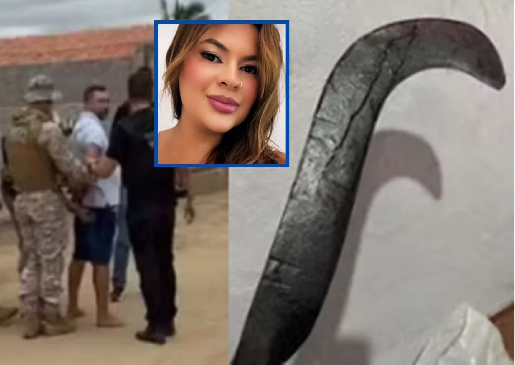 Jovem tem mãos reimplantadas após ataque brutal do ex no Ceará