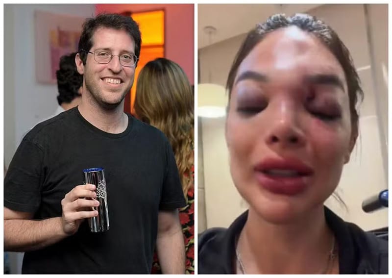 Dentista relata agressões que sofreu do marido, empresário do setor financeiro da Faria Lima