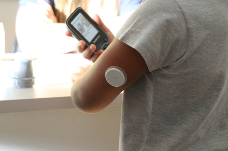Justiça manda fornecer sensor de glicose a jovem de 15 anos com quadro grave de diabetes