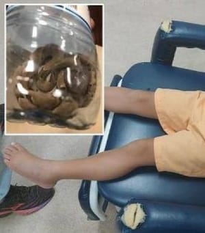 PM percorrem mais de 100 km para salvar criança picada por jararaca em área rural de Poconé