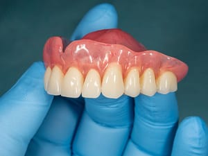 Consumidora será indenizada após plano odontológico negar prótese dentária, decide TJMT