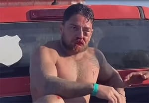 Agressão em Porto de Galinhas: garçom diz que levou mata-leão de turista de MT após cobrança