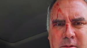 Pré-candidato à Presidência do Peru, Rafael Belaúnde, é alvo de atentado a tiros