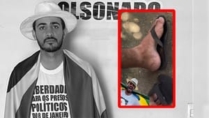 Supremo Tribunal Federal retira tornozeleira de bolsonarista de Cuiabá após mais de 3 anos