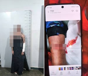 Mulher é presa após ataque contra filho de 3 anos e tentativa contra a própria vida