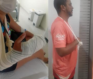 Mulher tem quatro dedos amputados ao tentar se defender de ataque do ex em Cuiabá