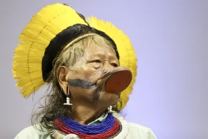 Cacique Raoni apresenta melhora na UTI, respira sem aparelhos e passa por endoscopia em Sinop