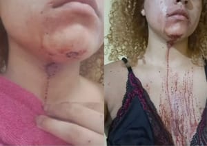 Moradora denuncia agressão e ameaça durante abordagem de policiais dentro de casa em Cuiabá